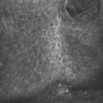 Konfokale Laserscanmikroskopie (KLSM) - Bild 1