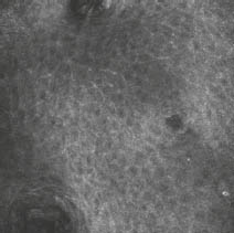 Konfokale Laserscanmikroskopie (KLSM) - Bild 2